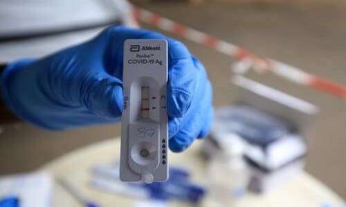 На Волині помер чоловік від ускладнення коронавірусної інфекції